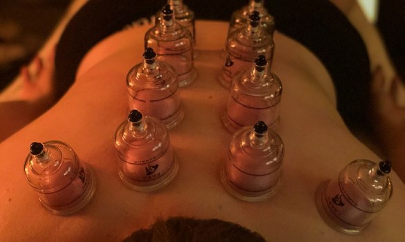 Cupping Massage